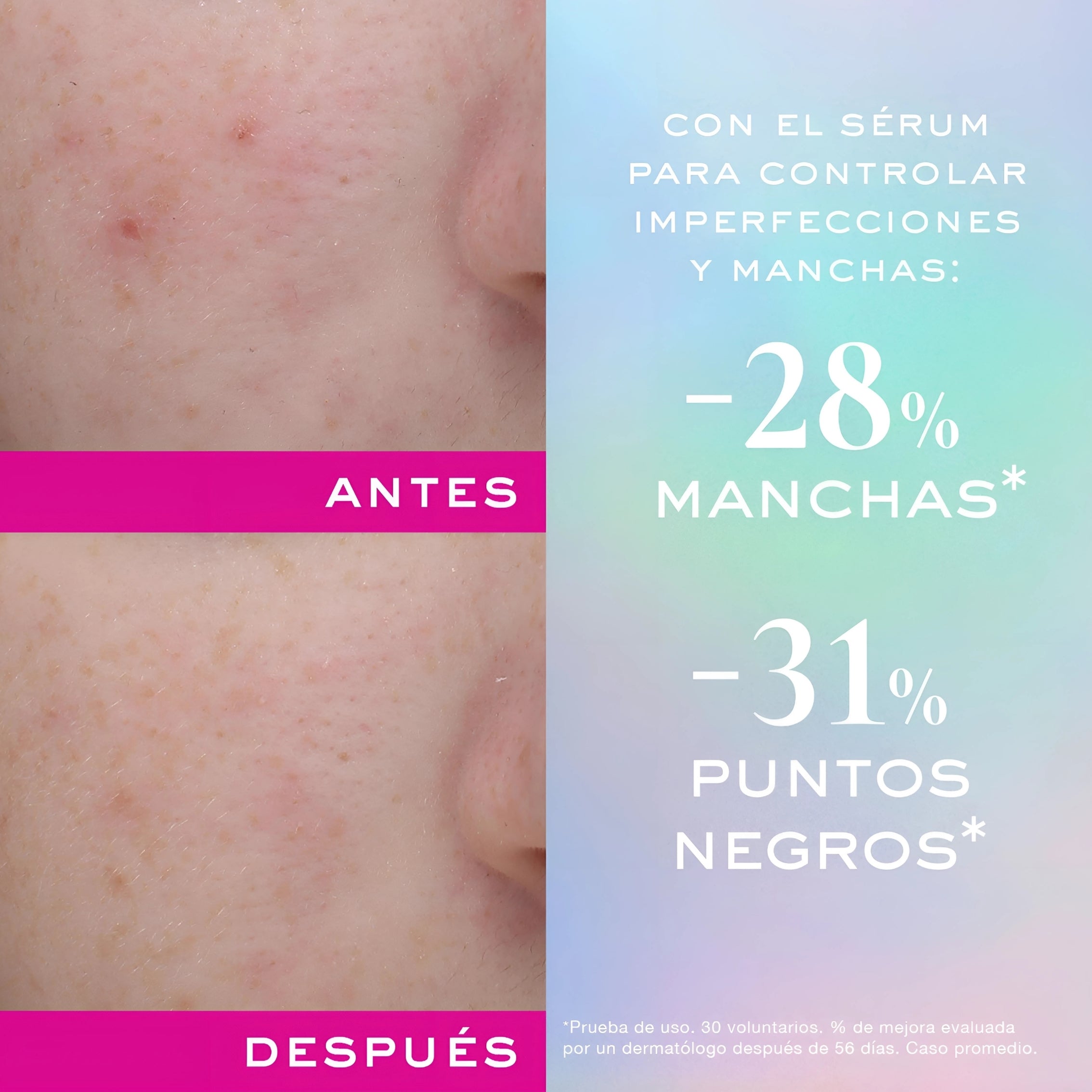 Nuxe Zinc Power Serum Anti-Imperfecciones 30ml - Control Acné, Manchas y Poros , Matifica e Hidrata