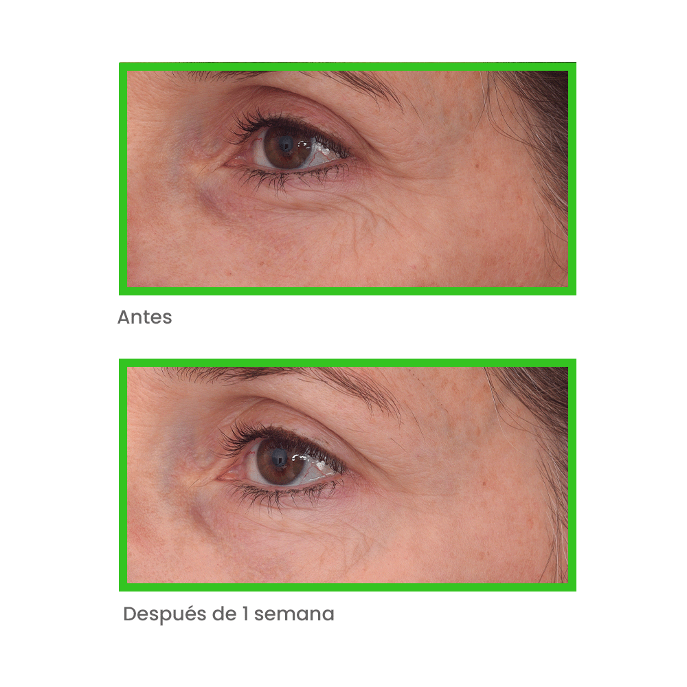 Murad Retinal Resculpt Eye Treatment 15ml - Contorno Ojos Antiedad, Eleva Párpados y Reduce Arrugas