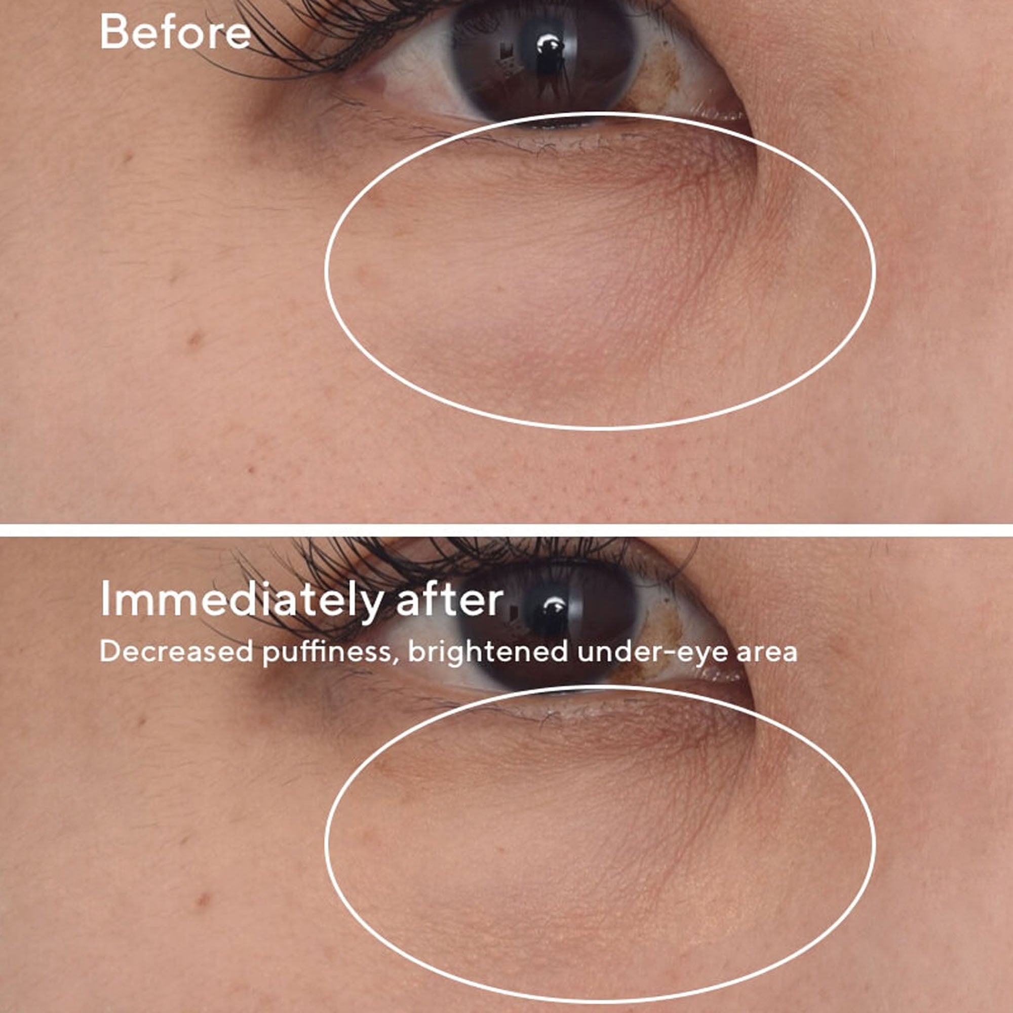Murad Targeted Eye Depuffer 15ml – Tratamiento Reafirmante y Desinflamante para Ojos