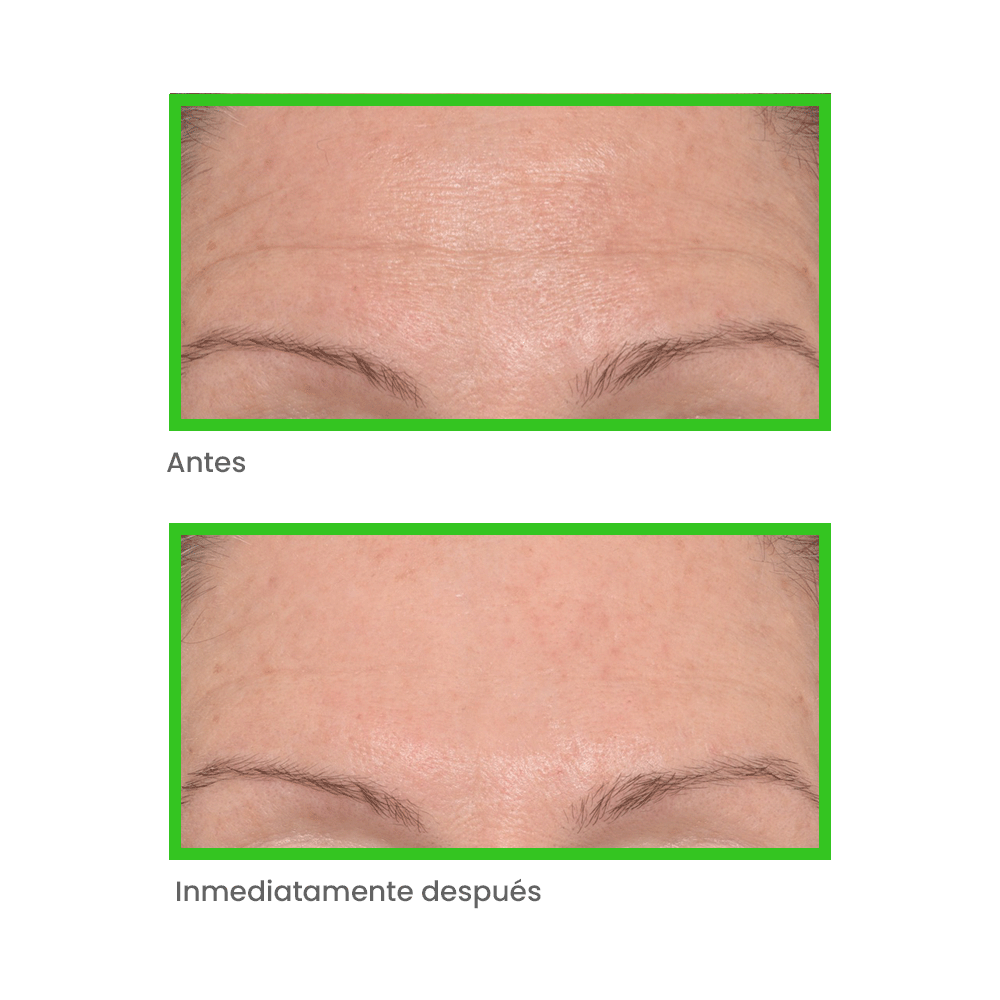 Murad KIT Derm Remedies: Solución Antiarrugas - Rellena e Hidrata con Péptidos y Ácido Hialurónico