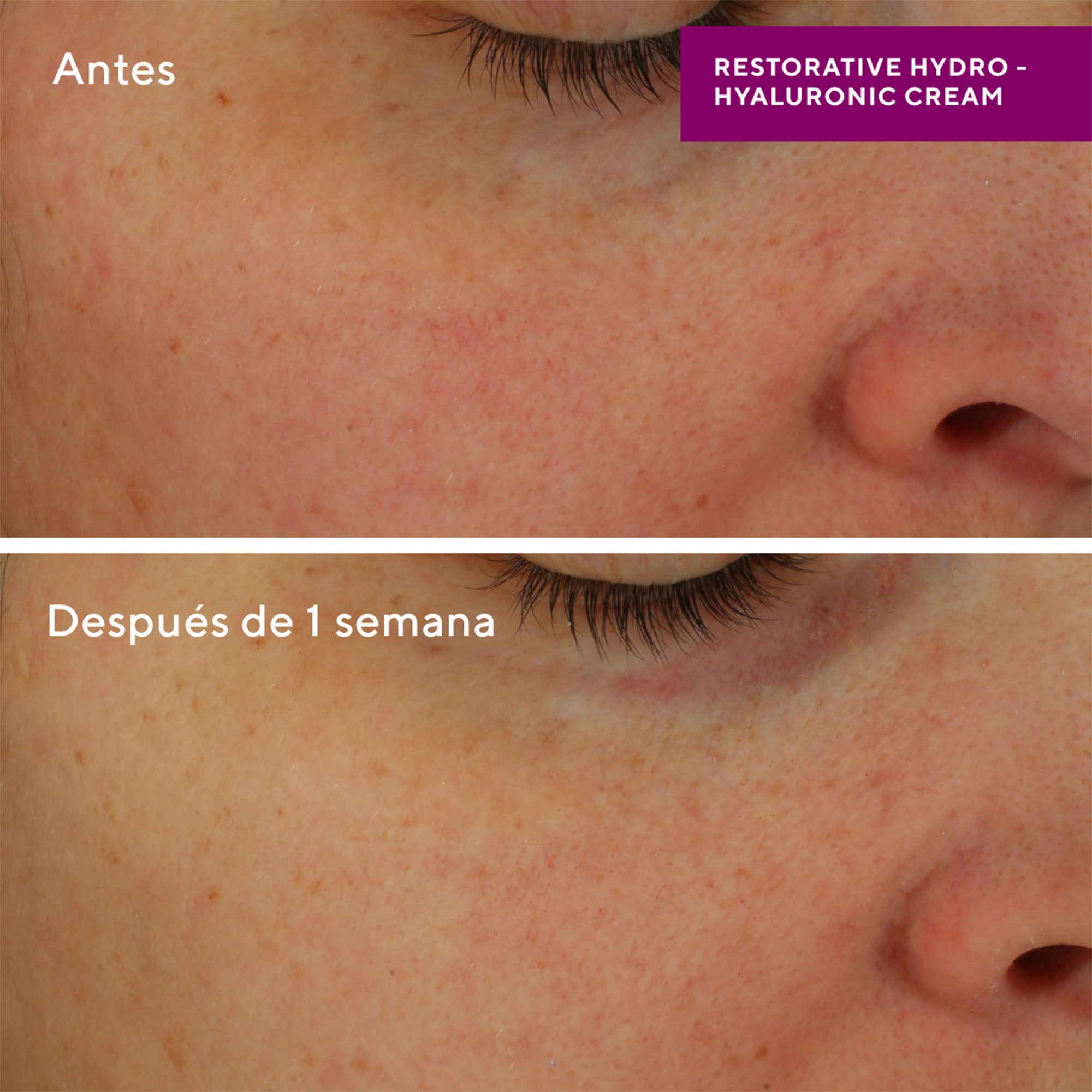 Murad Restorative Hydro-Hyaluronic Cream 50ml - Crema Hidratante con Ácido Hialurónico, Reafirmante