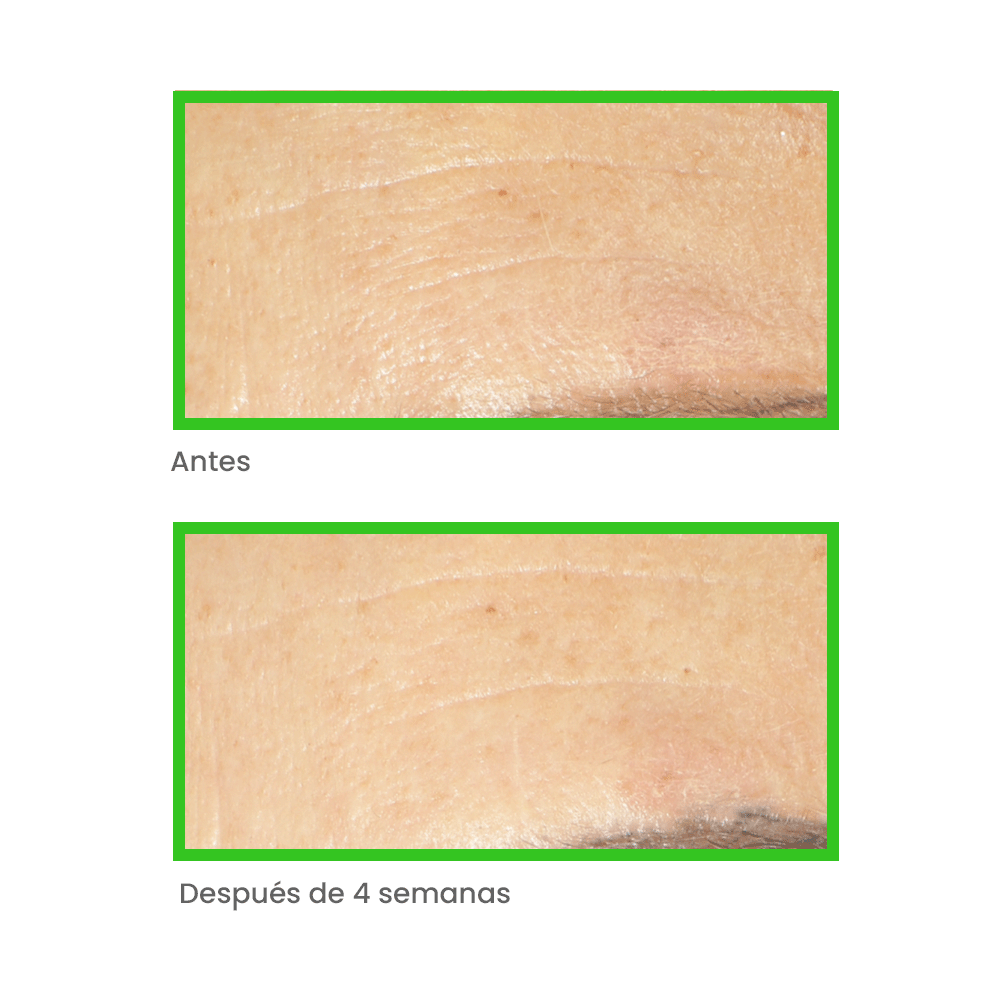 Murad KIT Derm Remedies: Solución Antiedad y Antimanchas con Retinol y Vitamina C
