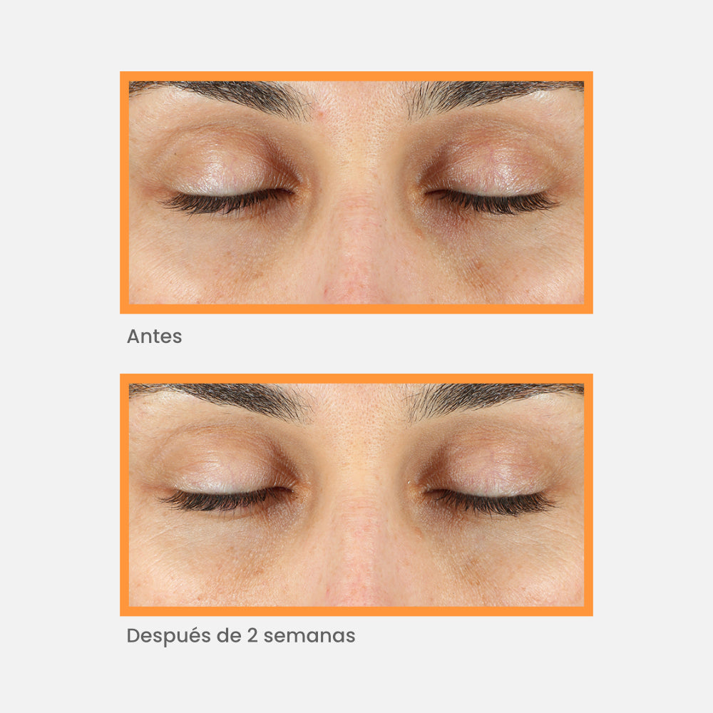 Murad - Manchas - Vita-C Eyes Dark Circle Corrector 15 ml - ebeauty