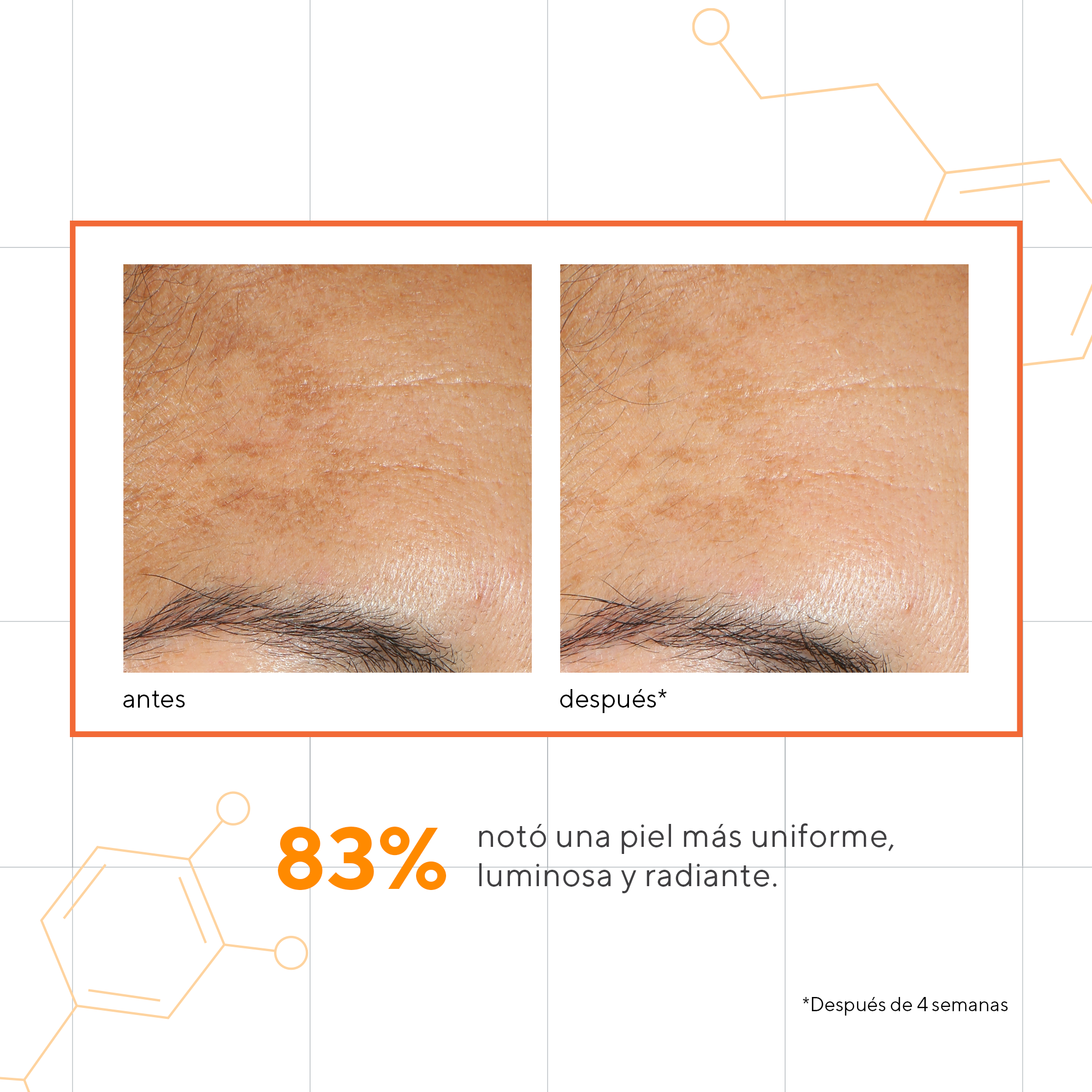 Murad - Manchas - Vita -C Glycolic Serum 30ml - ebeauty