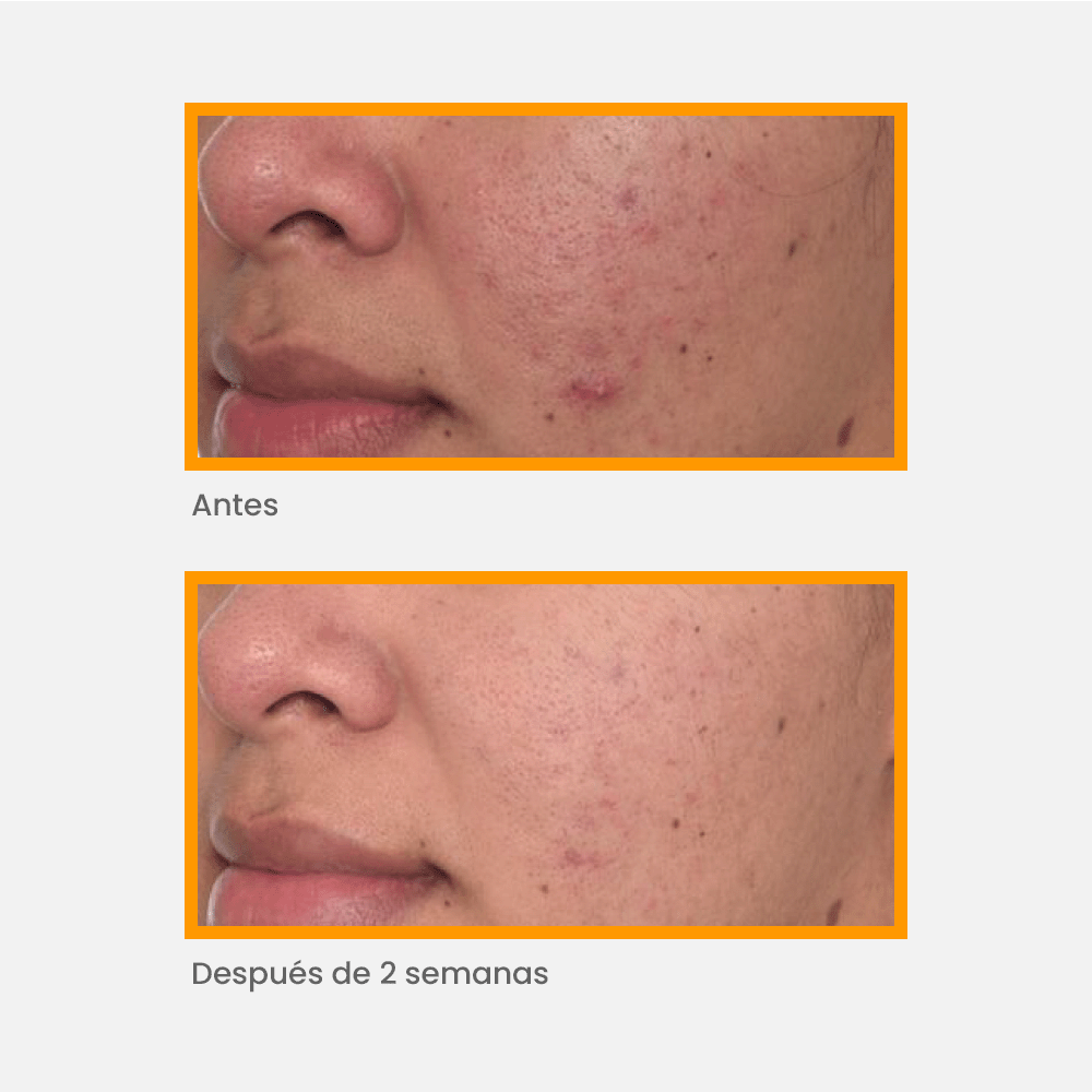 Murad - Antimanchas - Rapid Dark Spot Correcting Serum 30 ml - ebeauty