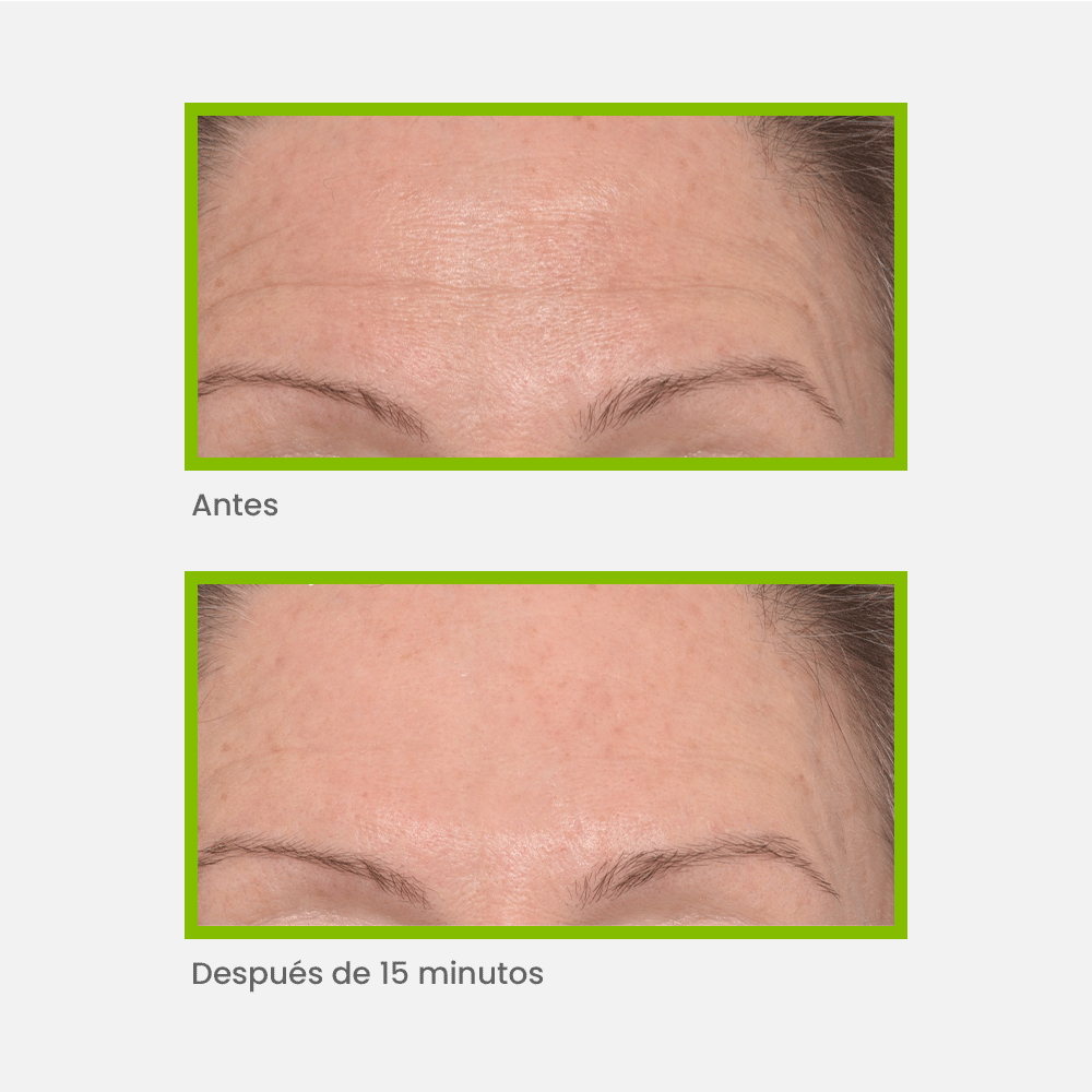 Murad - Antiedad - Targeted Wrinkle Corrector 15 ml - ebeauty