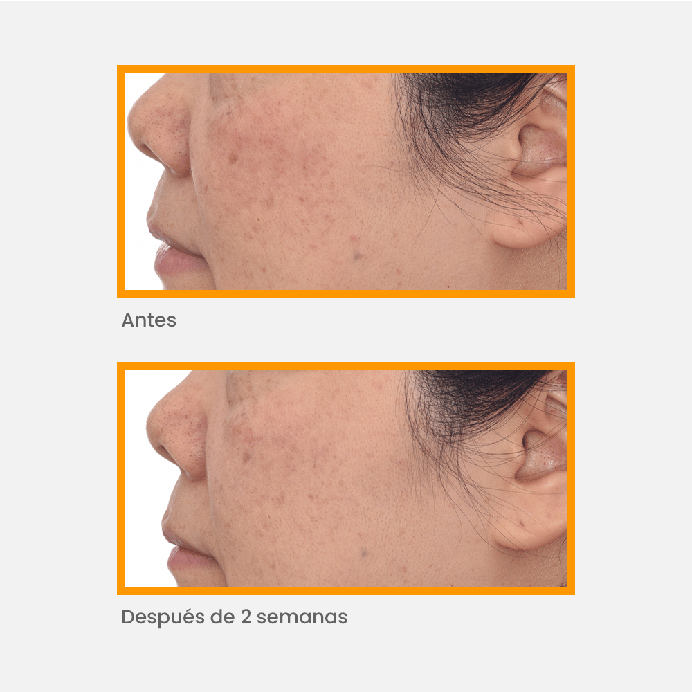 Murad - Manchas - Correct & Protect Serum SPF 45 PA|++++ - ebeauty