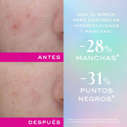 Nuxe Zinc Power Serum Anti-Imperfecciones 30ml - Control Acné, Manchas y Poros , Matifica e Hidrata