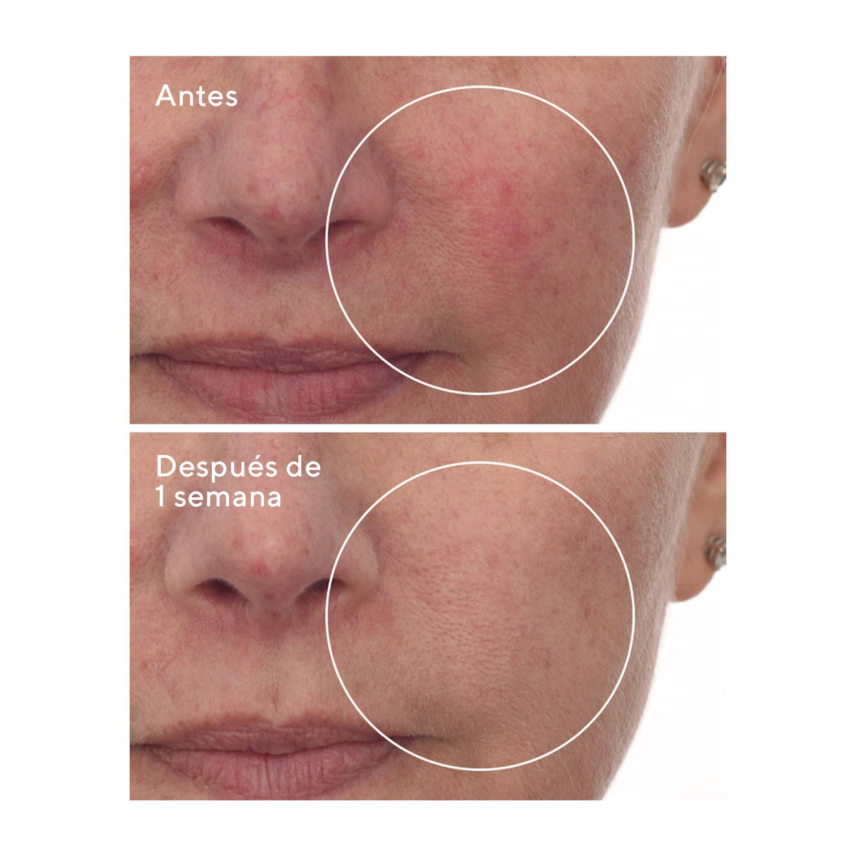 Murad Cellular Hydration Repair Serum 30ml - Suero Reparador Celular de Hidratación Profunda