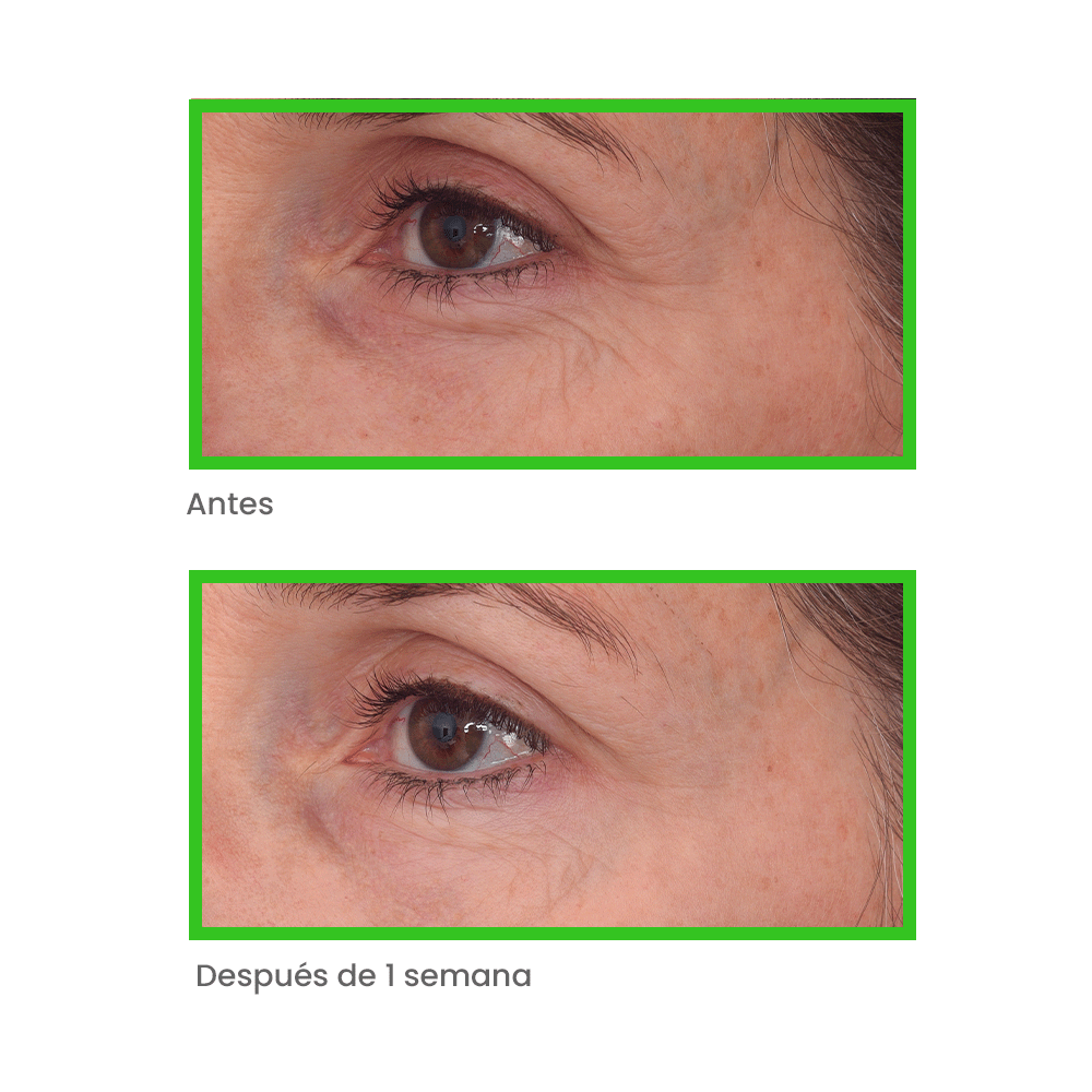 Retinal Resculpt Eye Treatment - Tratamiento intensivo antiedad para ojos 15ml