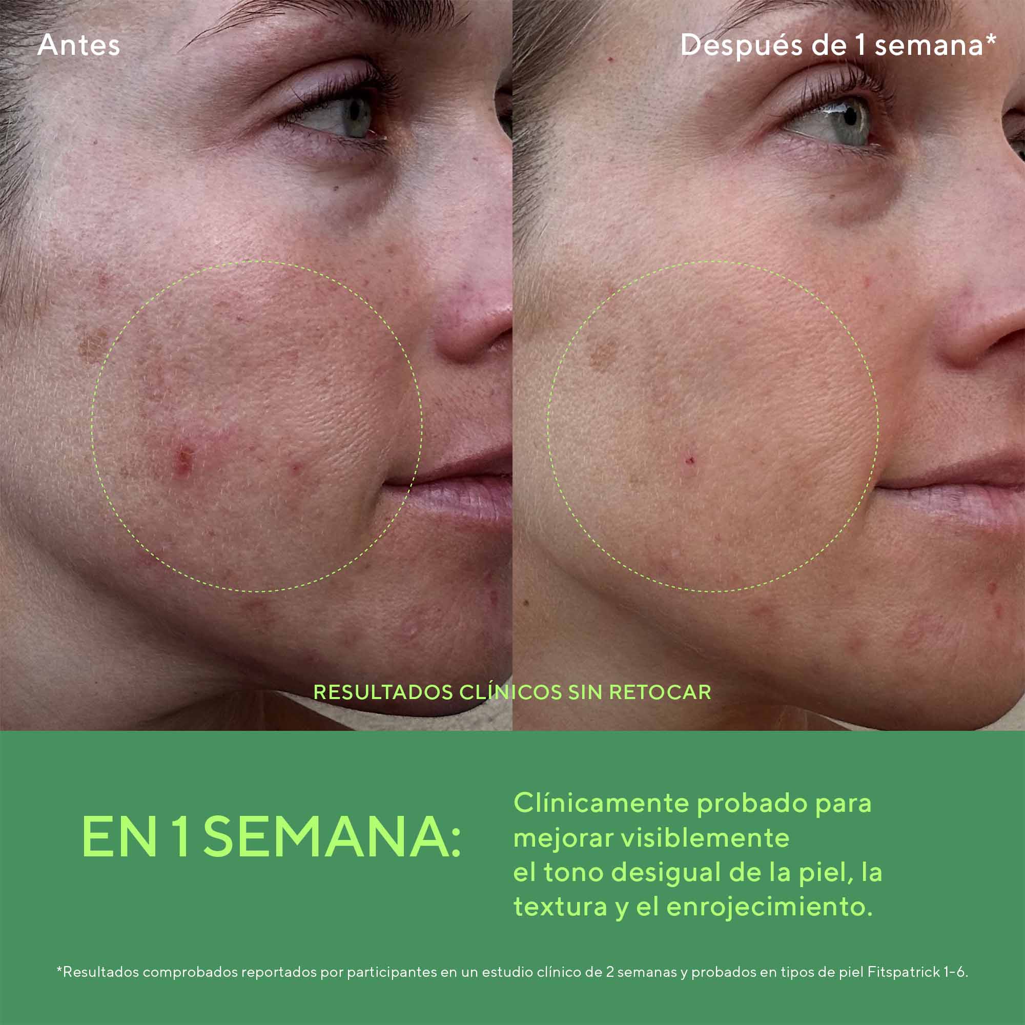 Murad Biome Balancing Calm + Recover Cream 50 ml - Crema Facial Calmante Reparadora Post-Acné