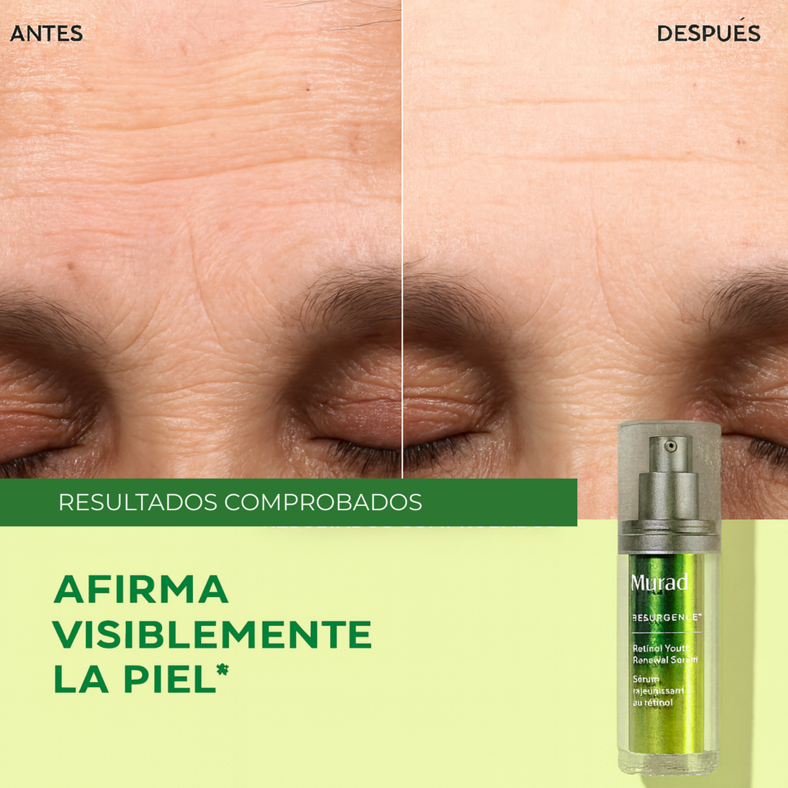 Murad KIT The Wrinkle Fighters Duo Serum - Suero Antiarrugas con Retinol 30ml + 15ml