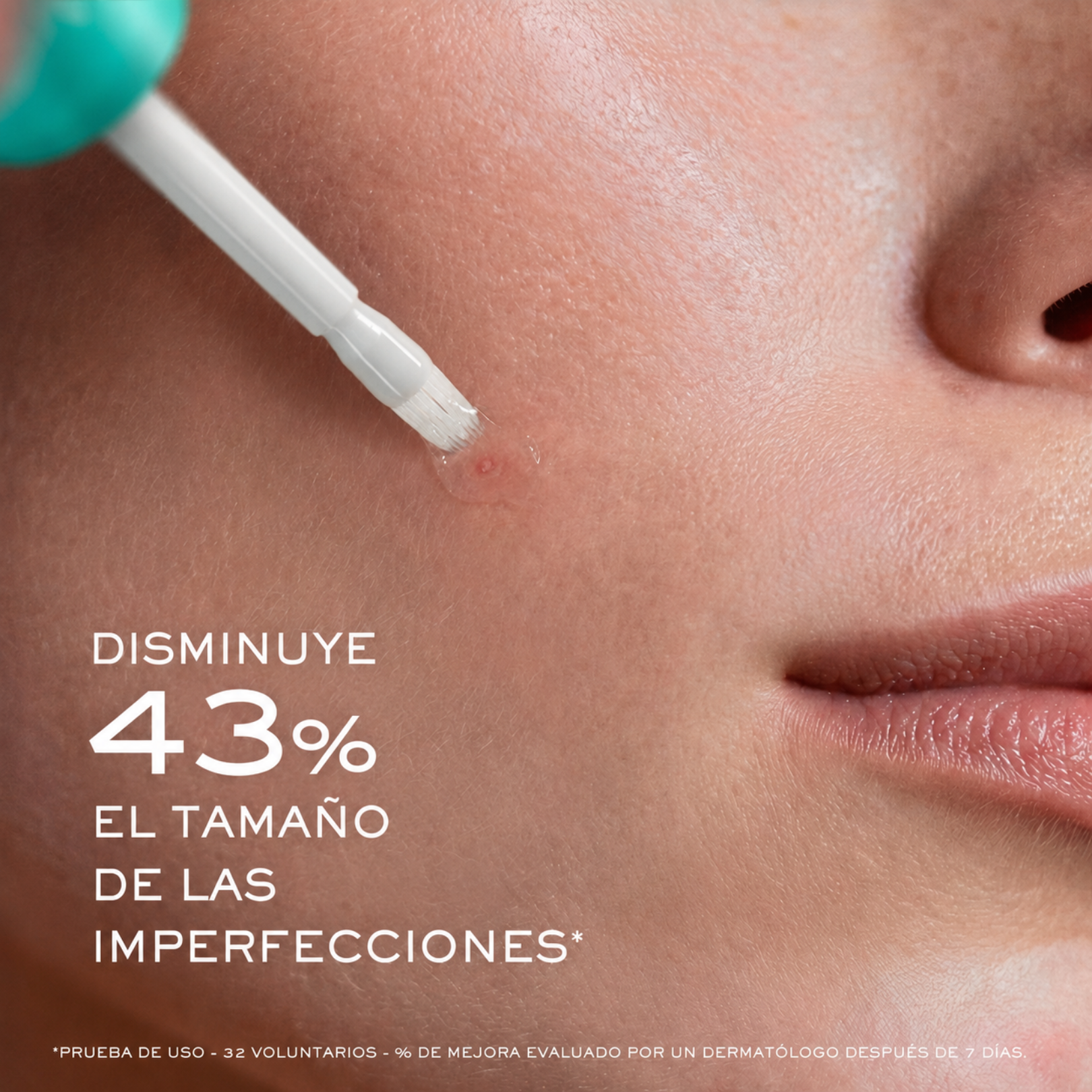 Nuxe Zinc Power Spot Corrector 10 ml - Corrector Removedor de Granos de Acné de Rápida Acción